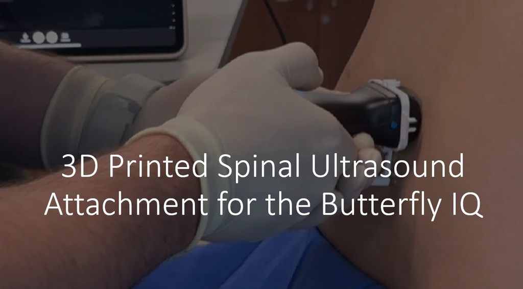Spinal Ultrasound Adapter for Butterfly IQ
