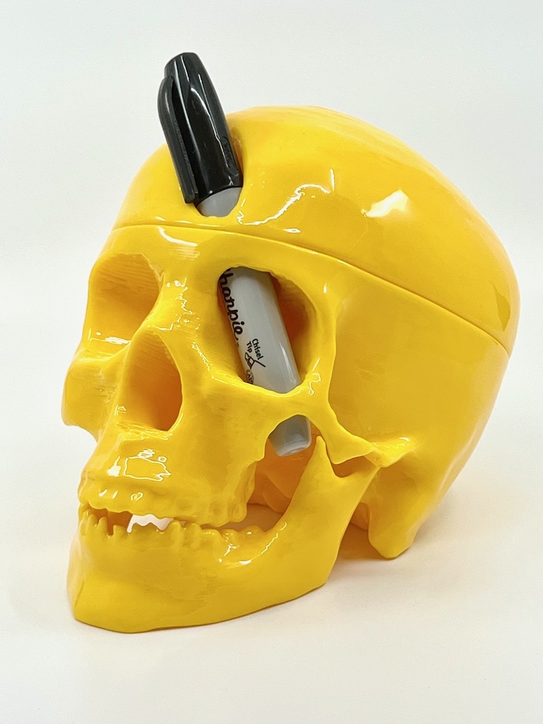 Phineas Gage Skull