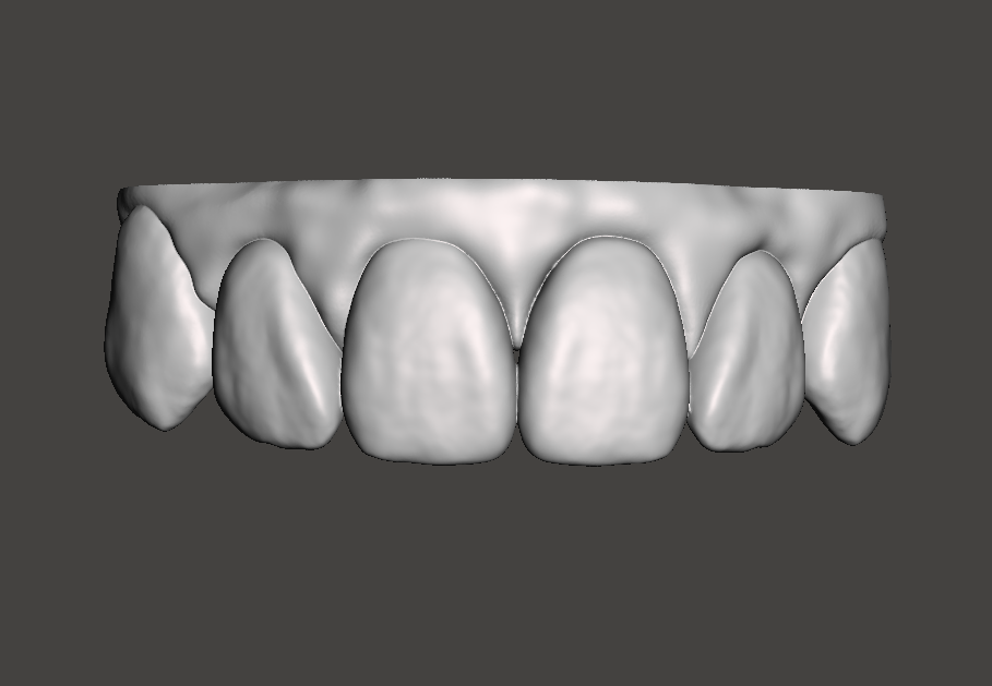 Dental model. Up front teeth part. (Ready to print)