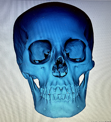  Cranium scanned