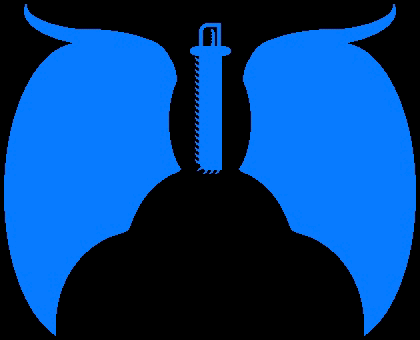 Blue_Icarian_wings