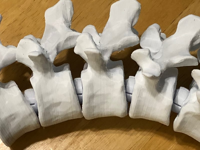 Articulating Lumbar Vertebrae