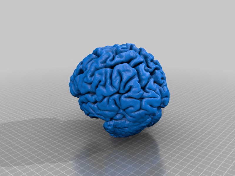 Human brain from MRI