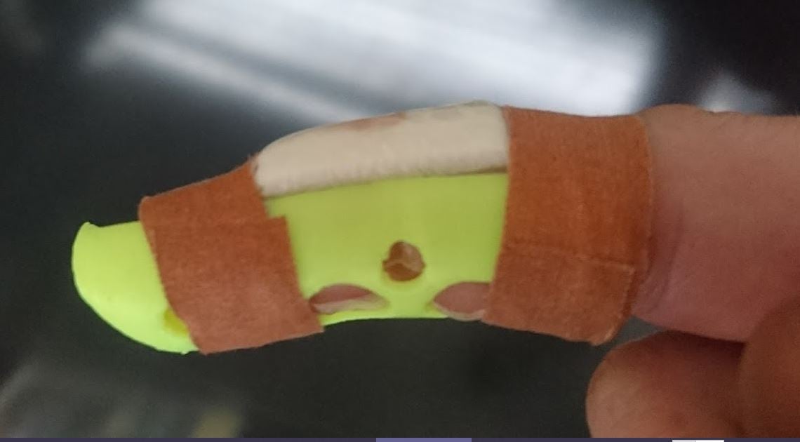 Finger Splint