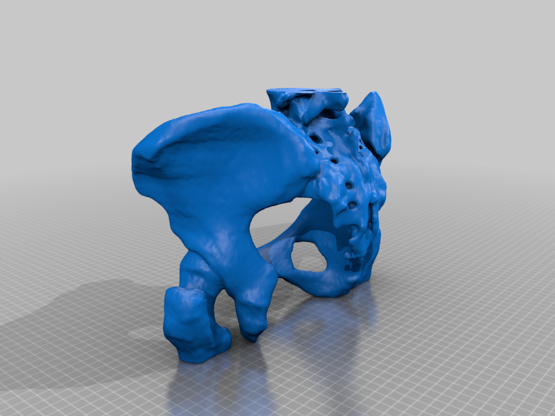 Female Pelvis Tomography Scanned