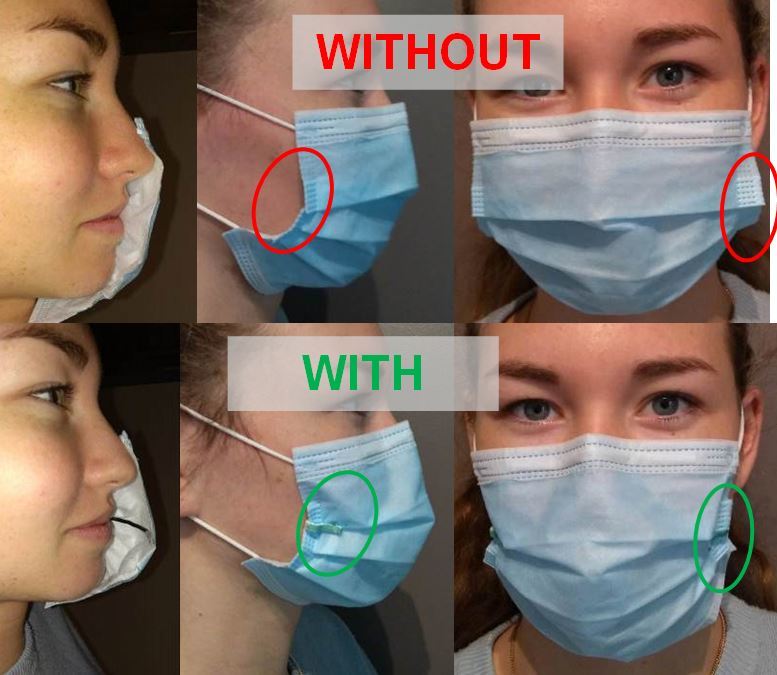 Surgical mask retractor COVID19 / Ecarteur de masque chirurgical