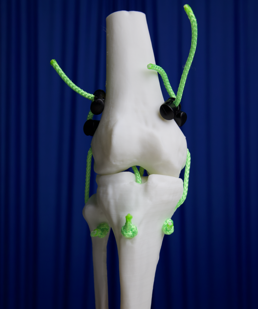 Femur, tibia and fibula with tunnels for cord to replicate ligaments