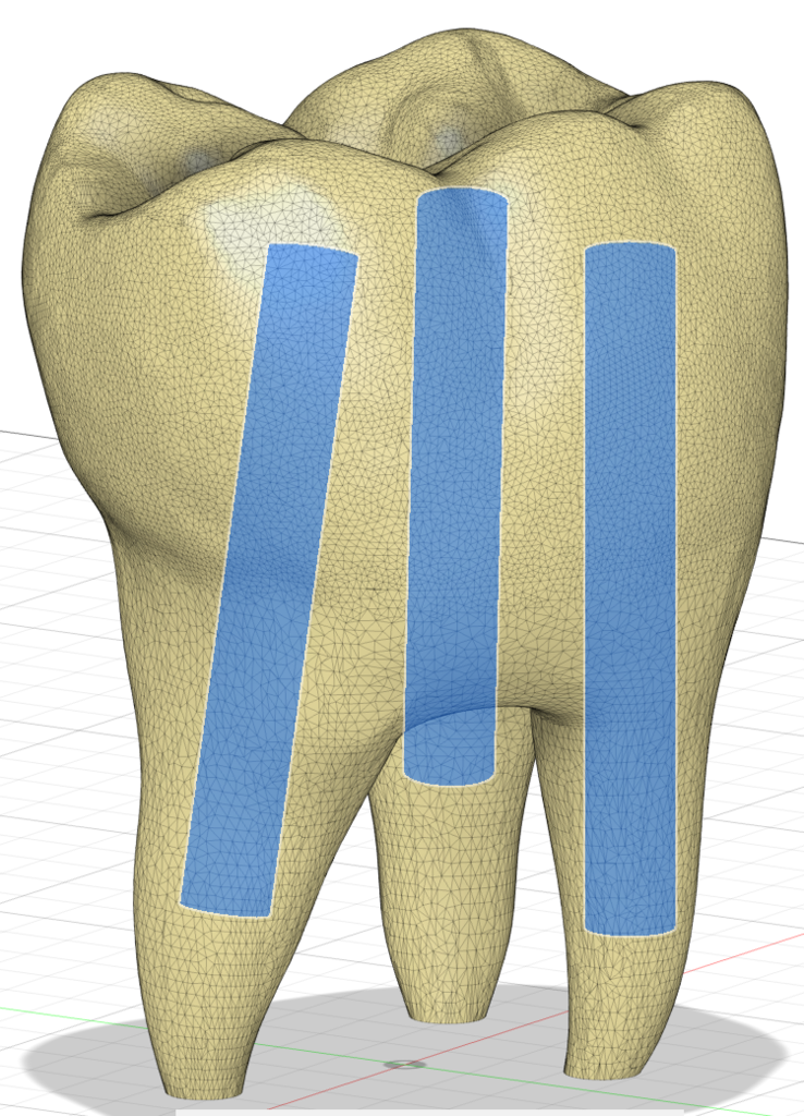 Human Tooth model with Money Rolls inlets 