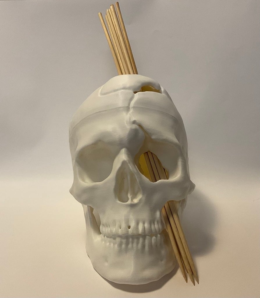 The Skull of Phineas Gage - Clean Resculpt