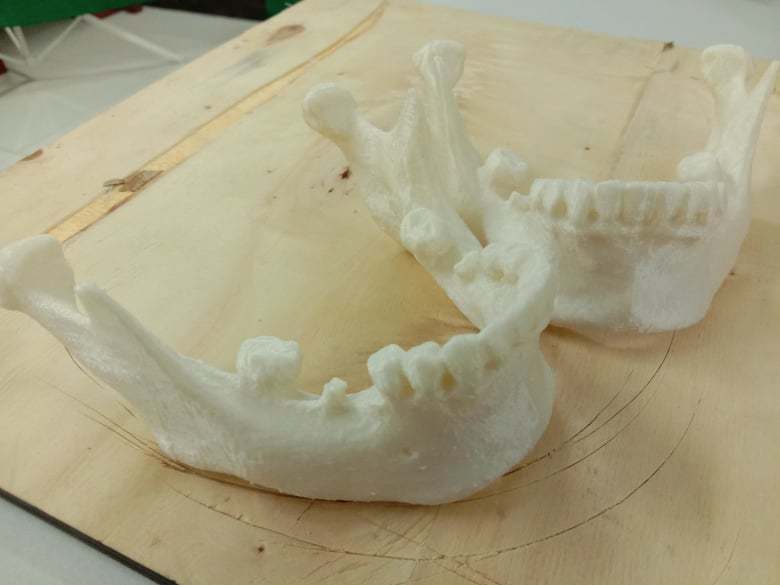 Human Mandible - Lower Jaw Bone (Gender: Female)