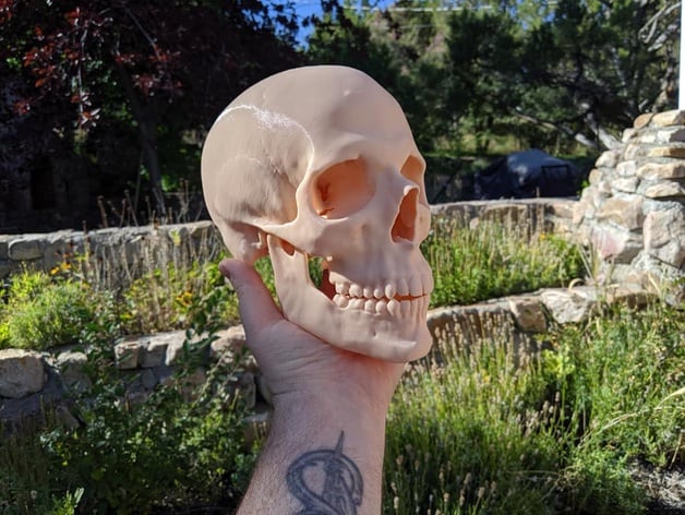 Human Skull Medical Scan