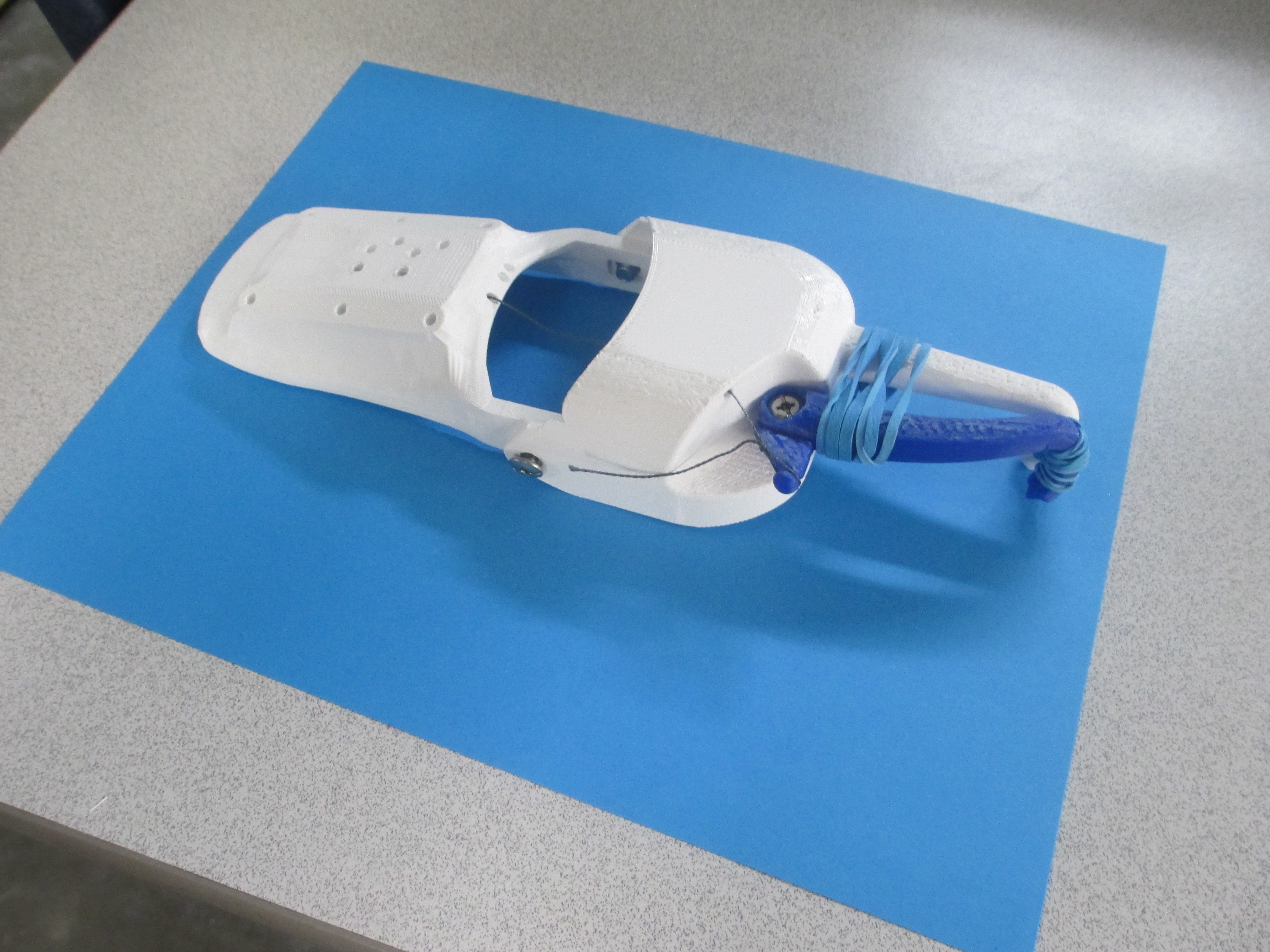 Prosthetic Hook Hand
