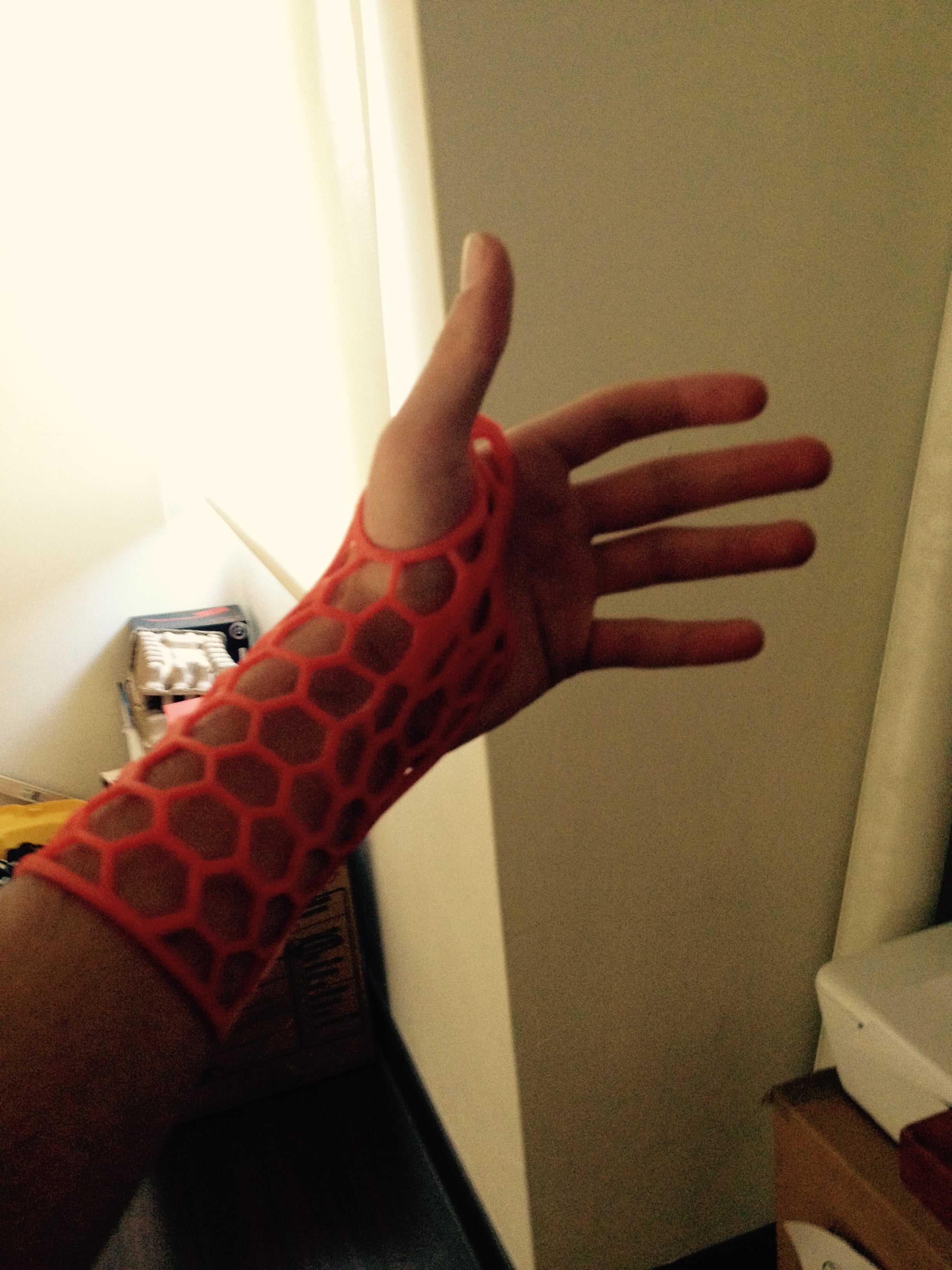 3D Wrsit brace/ arm cast