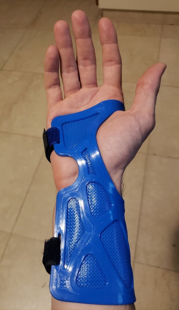 Wrist Splint - Férula / ferula muñeca - Wrist brace - Arm Cast - Orthosis