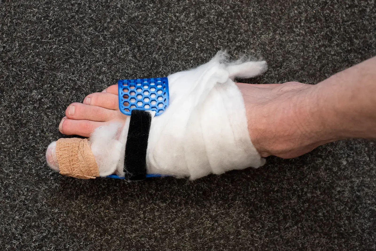 Big Toe Brace