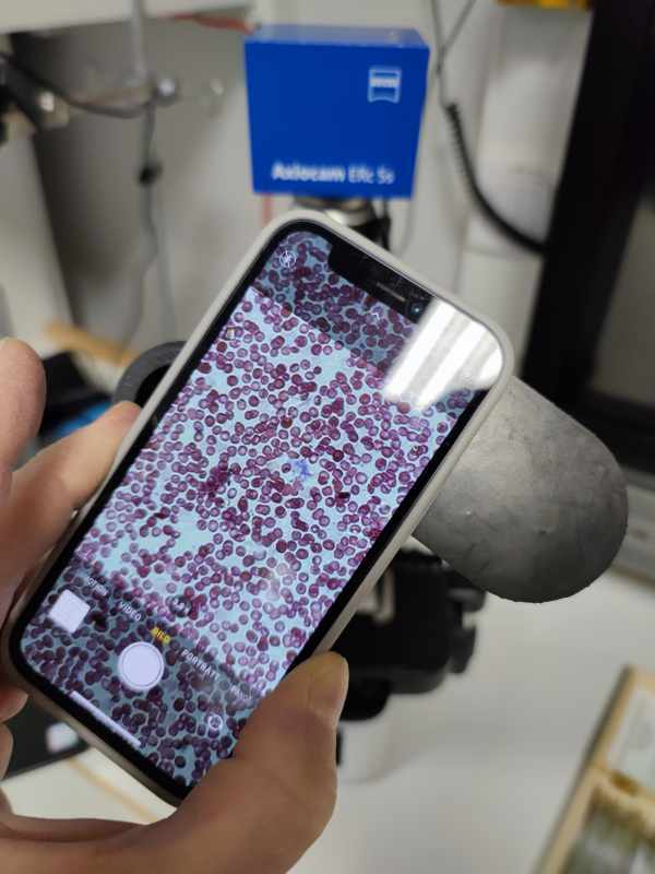 Mobile Camera to Microscope ( Spacer )