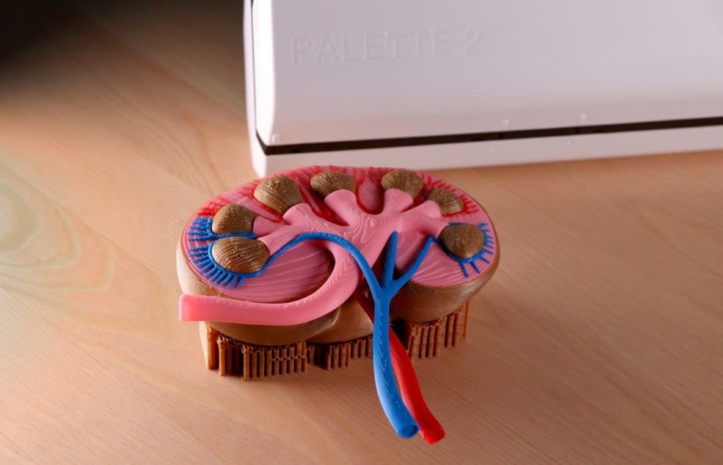 Multi-Color Kidney Model
