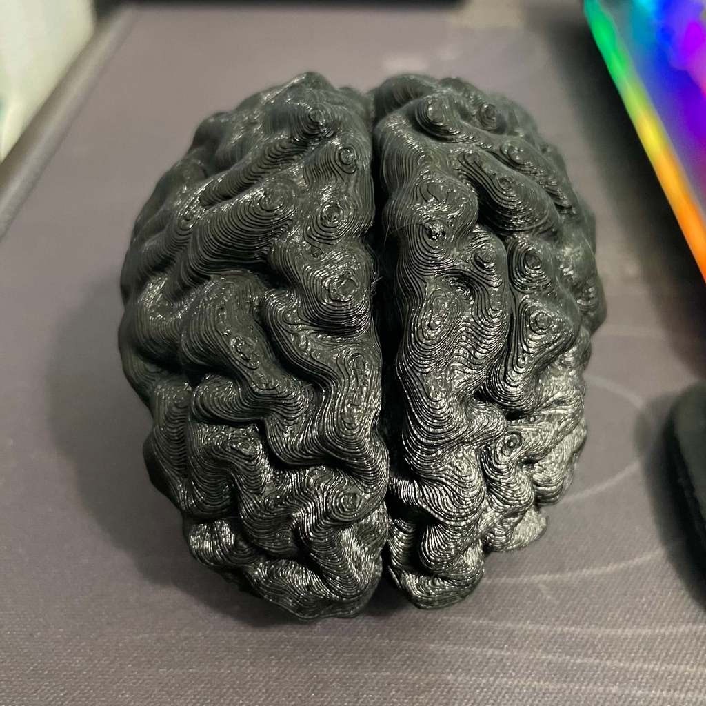 Human Brain - Converted MRI Scan of Real Human Brain