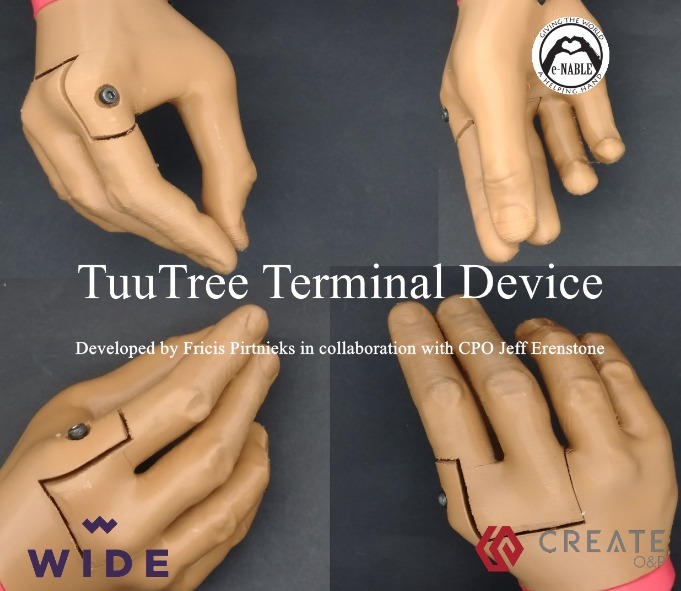 TuuTree Terminal device - Prosthetic