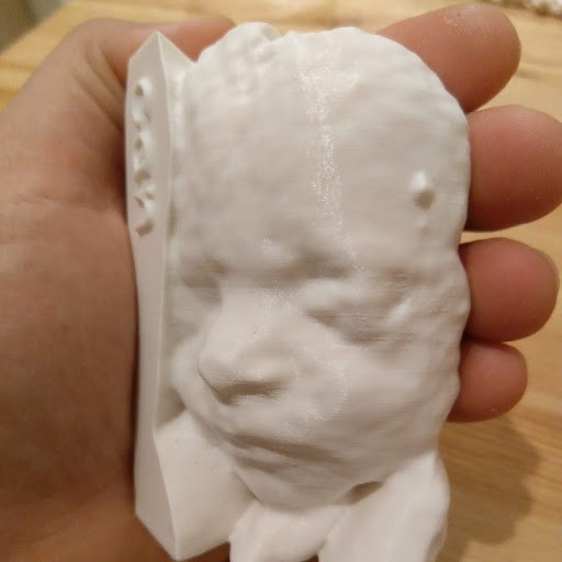 3D Ultrasound Scanned Fetus
