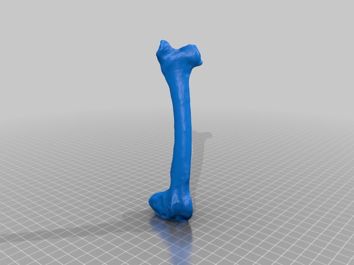 3D scan of a bone cast