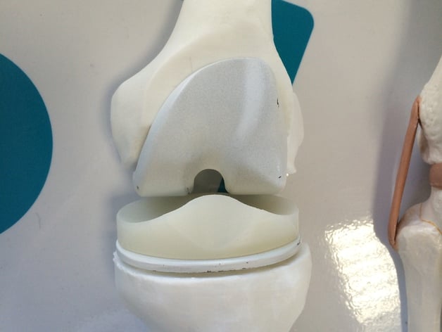 Knee prosthesis model