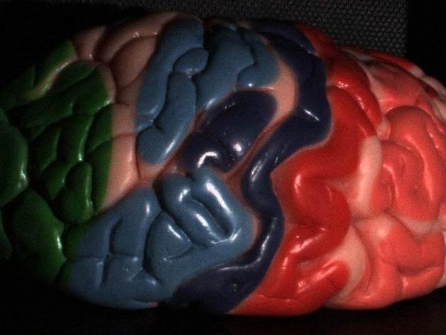 Scan from model of human brain