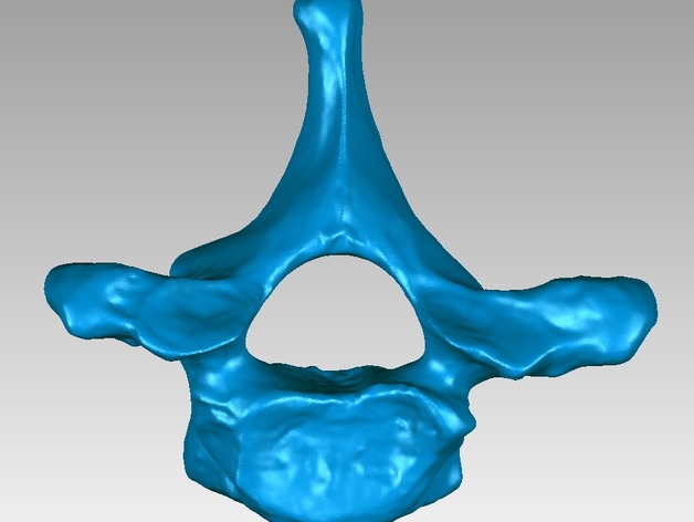 Thoracic vertebra of a human