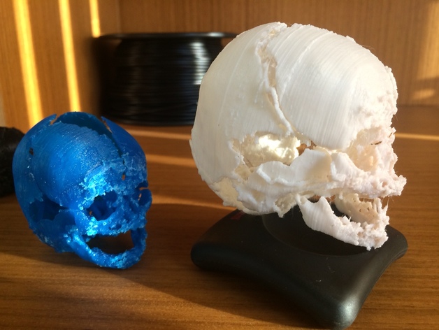 Newborn skull