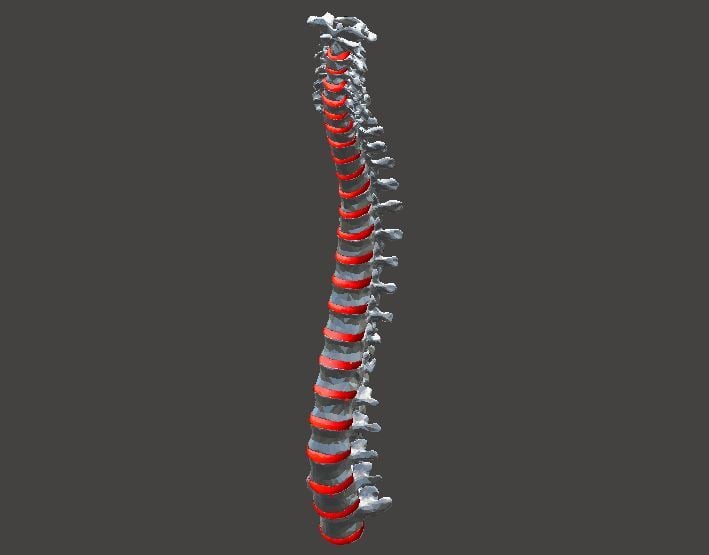 Spine - vertebrae and disks