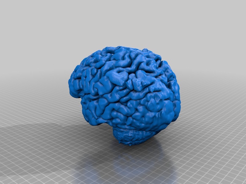 Human Brain from MRI Scan