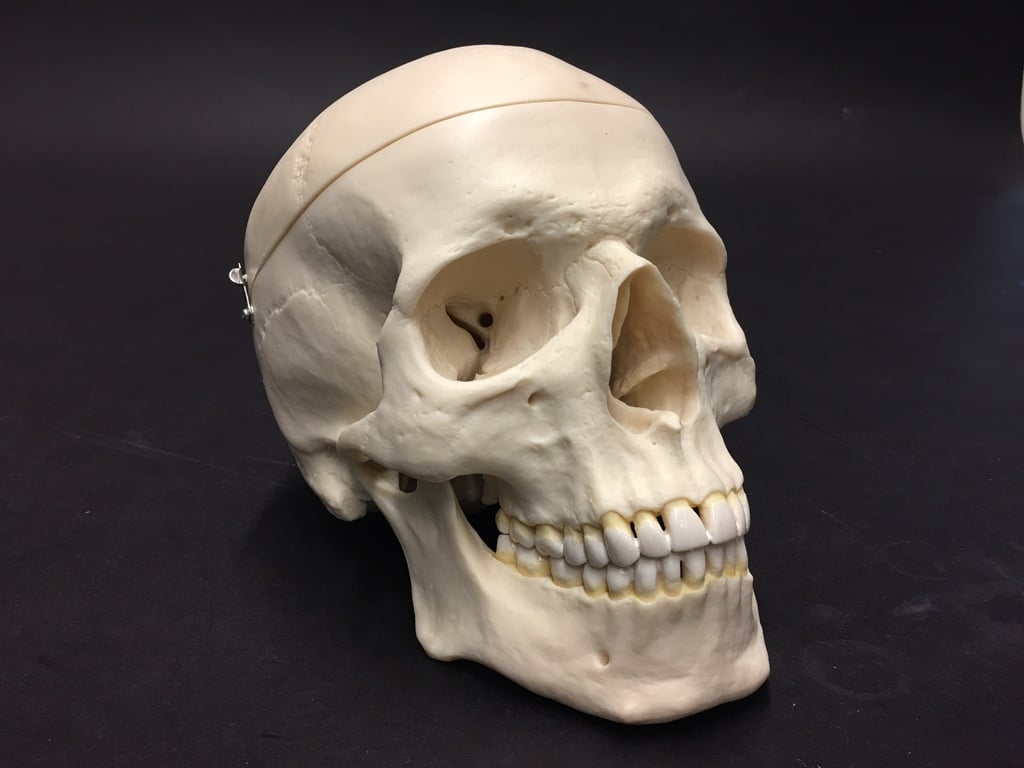 Human skull scan