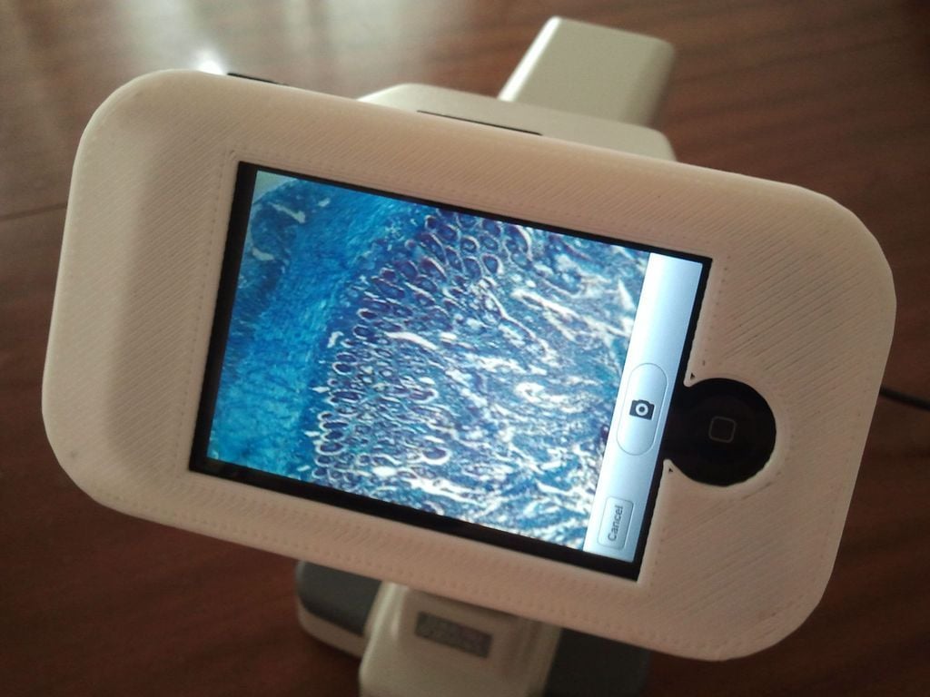 iPhone to Microscope mount