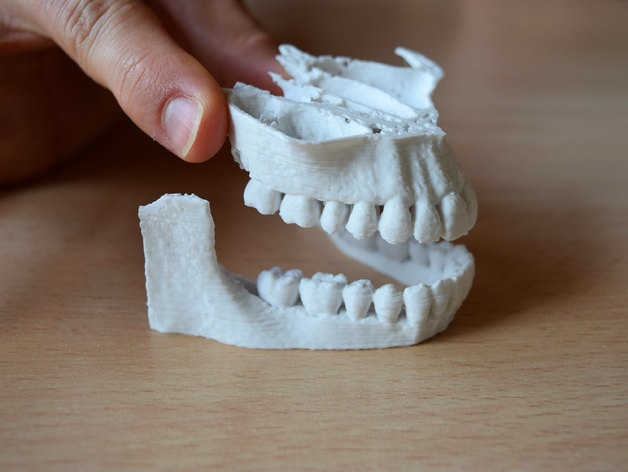 CT teeth