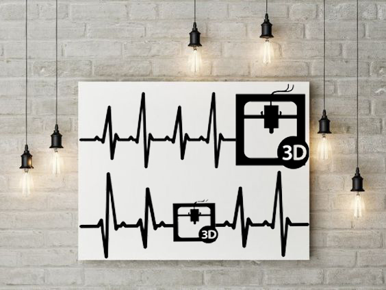 Heart Beat 3D printer  2D