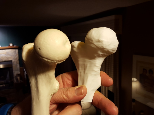 Alberta High School CTS - 3D Printed Bone Replacements