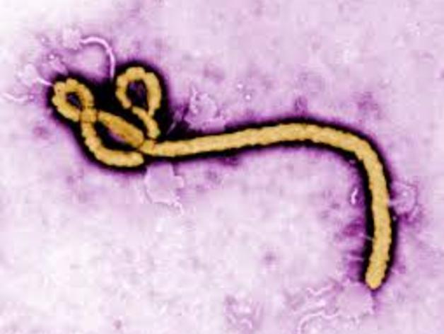 The Ebola Virus....