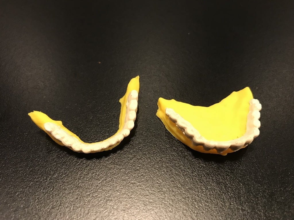 Laughing Face Separated Teeth