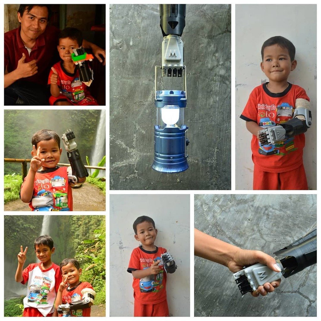 CRE-010 Hand Prosthetic for Children - iDIG (Integrated Digital Design Laboratory) Despro ITS