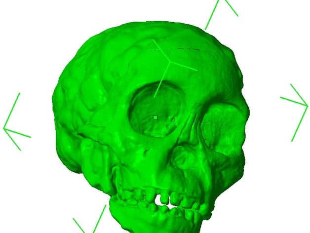 RadioLab Taung Child Skull (repaired, converted to mm)