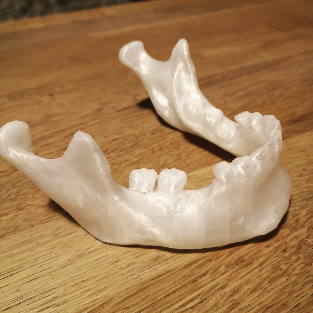 3D Scanned Human Mandible / Jaw Bone